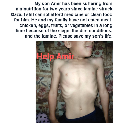 If you doubt my son's suffering, I am ready to go live and show you his condition. I have nothing to hide—only a desperate hope to save my child. Please, look at him as if he were your own son. Every share and every donation could give him a chance to survive. We've received only $5 in the last 10 days. Please don't leave him alone.
https://chuffed.org/project/179480-help-mohammad-in-gaza-rebuild-after-unimaginable-loss
Gaza #palestine #israel #iran #usa #us #health #helpgaza #help #canada #china #uspol #war #fediverse #freepalestine #canada #gazaverified